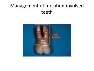 Management of furcation -involved teeth