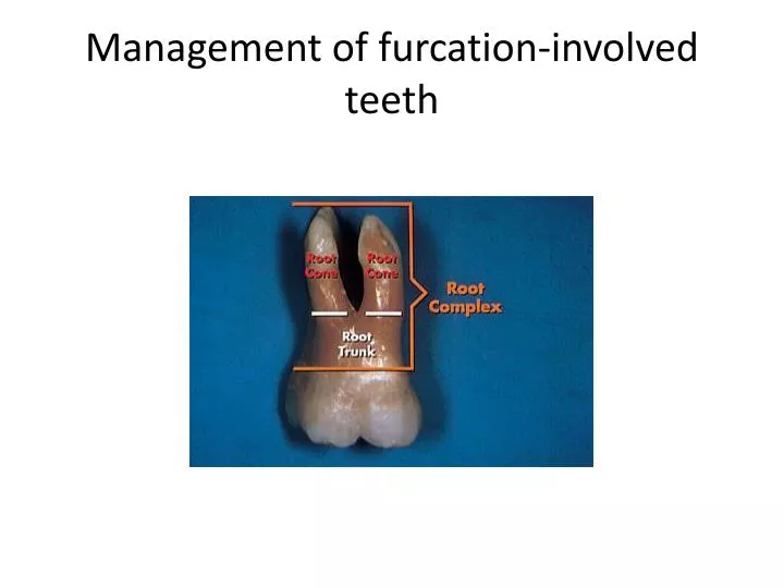 management of furcation involved teeth