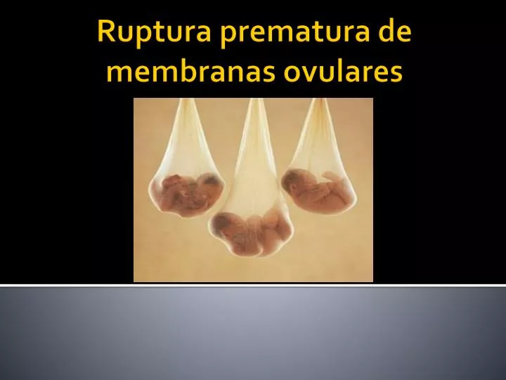 ruptura prematura de membranas ovulares