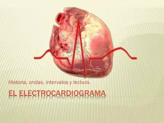 historia ondas intervalos y lectura