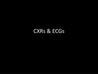 CXRs &amp; ECGs