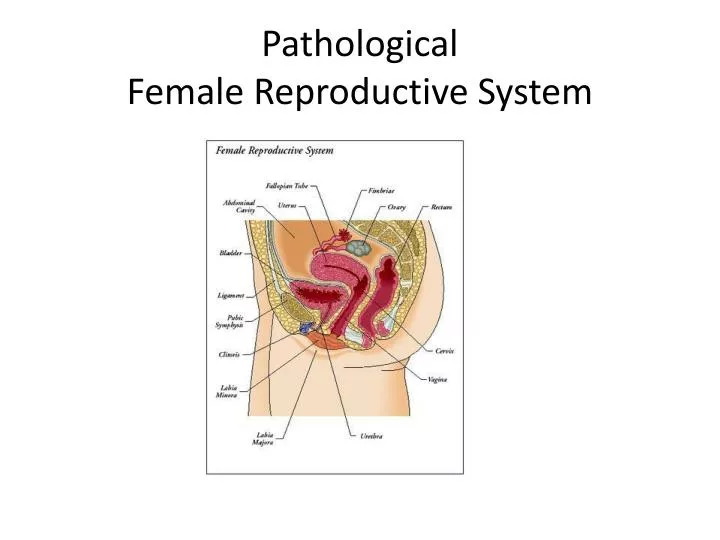 pathological female reproductive system