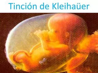 tinci n de kleiha er
