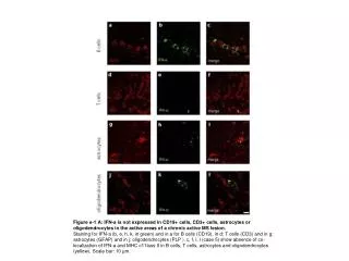 Figure e-1B : Plasmacytoid dendritic cells are not present in MS lesions.