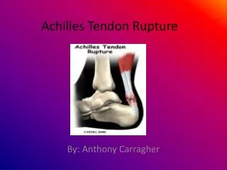 Achilles T endon Rupture