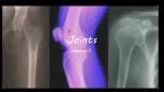 Joints - slide 1