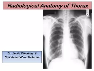 Radiological Anatomy of Thorax
