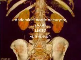 Abdominal Aortic Aneurysm (AAA) LECT7