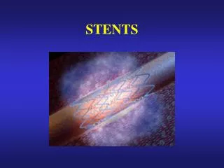 stents