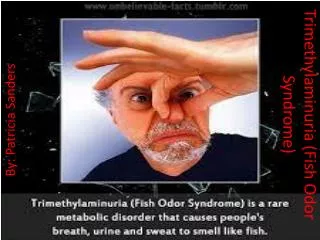 Trimethylaminuria (Fish Odor Syndrome)