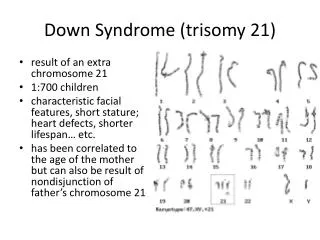Down Syndrome ( trisomy 21)