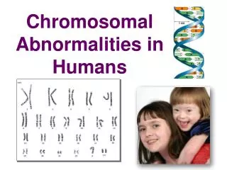 Chromosomal Abnormalities in Humans