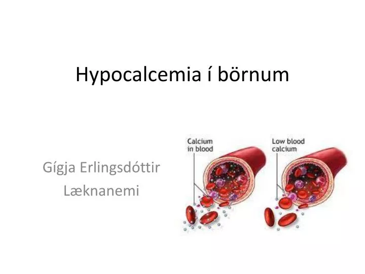 hypocalcemia b rnum
