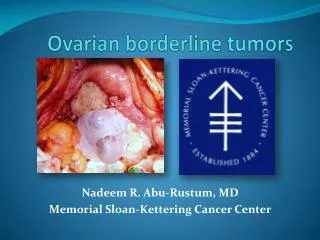 Ovarian borderline tumors