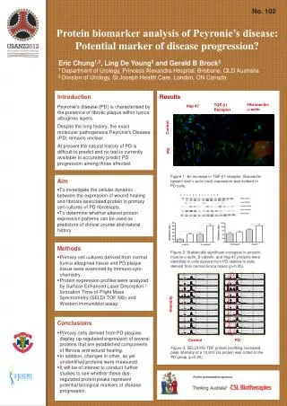 Protein biomarker analysis of Peyronie’s disease: Potential marker of disease progression?