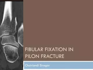 FIBULAR FIXATION IN Pilon F RACTURE