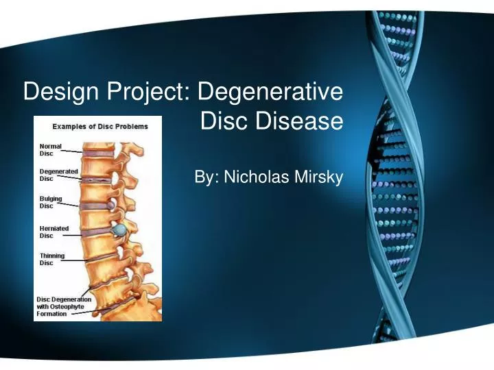 design project degenerative disc disease