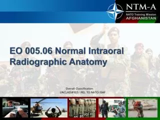 EO 005.06 Normal Intraoral Radiographic Anatomy