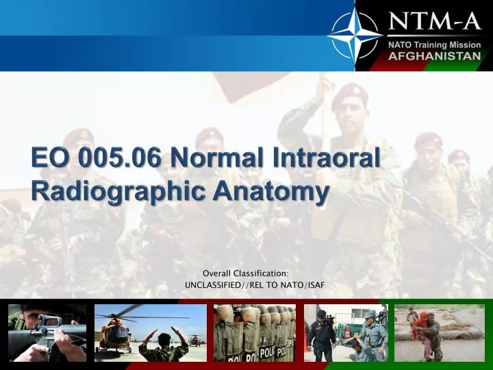 Ppt Eo Normal Intraoral Radiographic Anatomy Powerpoint