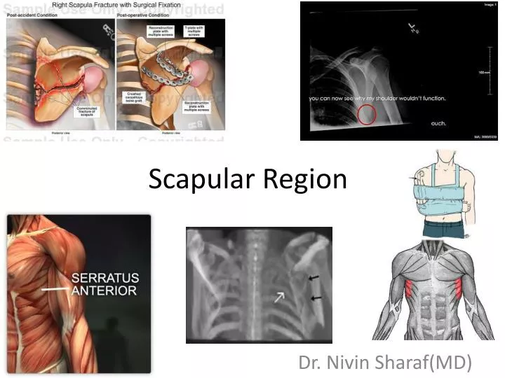 scapular region