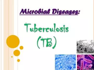 Microbial Diseases :