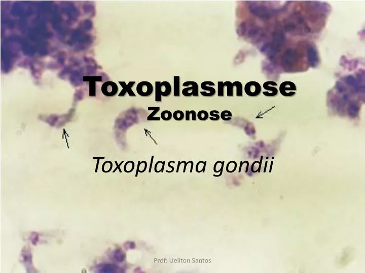 toxoplasma gondii