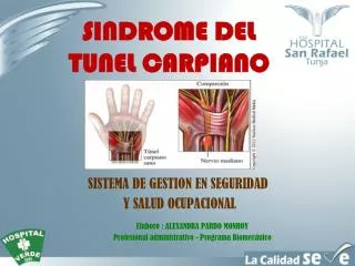 sindrome del tunel carpiano