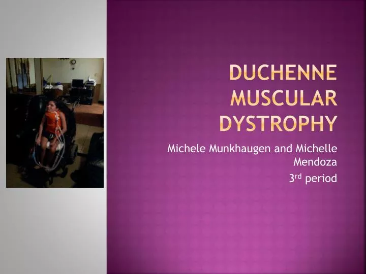 duchenne m uscular dystrophy