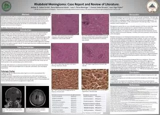 Rhabdoid Meningioma: Case Report and Review of Literature.