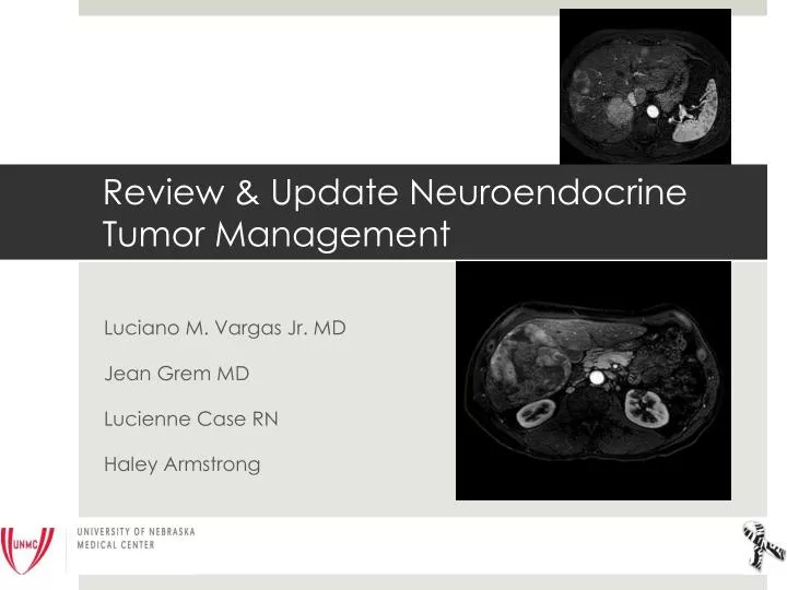 review update neuroendocrine tumor management