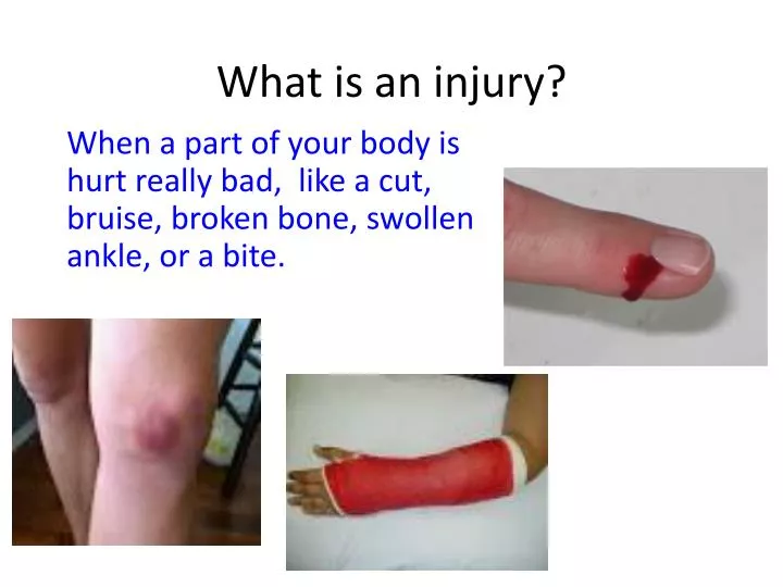 what is an injury