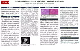Pulmonary Paragonimiasis Mimicking Tuberculosis in a Middle-Aged Burmese Female.