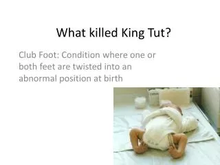 What killed King Tut?