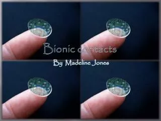 Bionic contacts