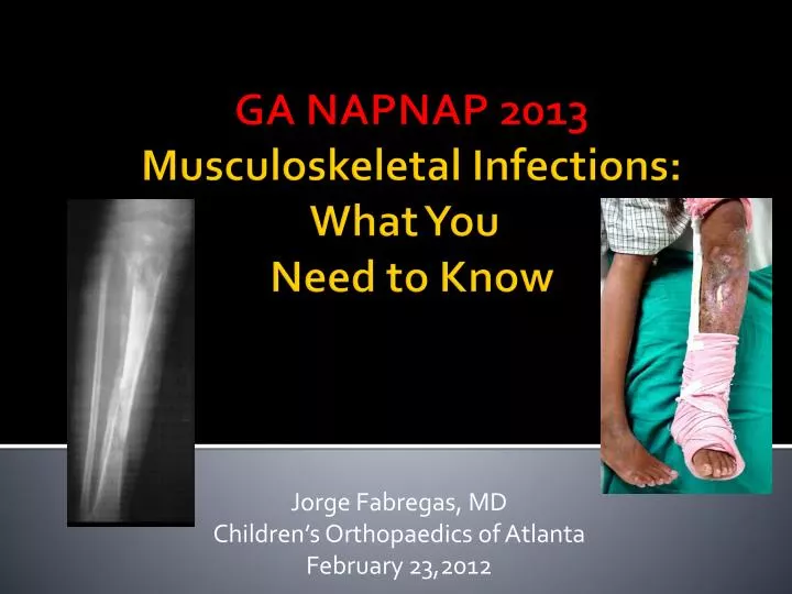 jorge fabregas md children s orthopaedics of atlanta february 23 2012