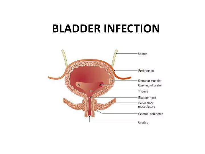 bladder infection