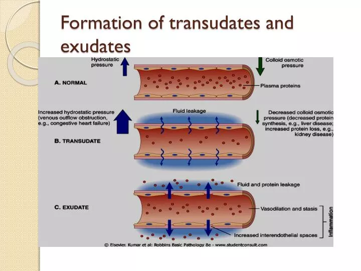 formation of transudates and exudates