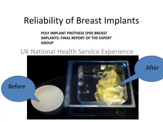Reliability of Breast Implants
