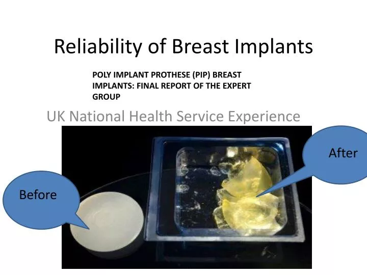 reliability of breast implants