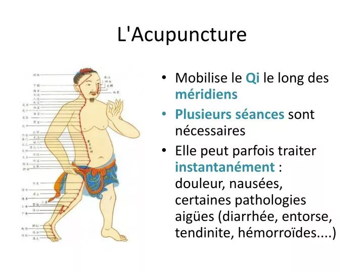 l acupuncture