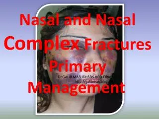 Nasal and Nasal Complex Fractures Primary Management