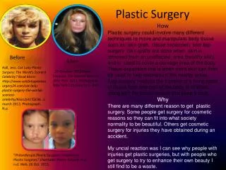 Plastic Surgery