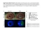 Clinical Metrics of Resolved Cornea vs. Cornea with MGK Development: Findings and Observations - slide 1