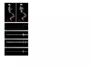 C. D. E. Lumbar Flexion F. R-Erector Spinae