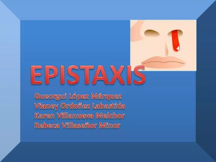 epistaxis