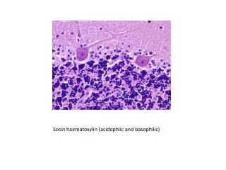 Eosin haematoxylin ( acidophlic and basophilic)