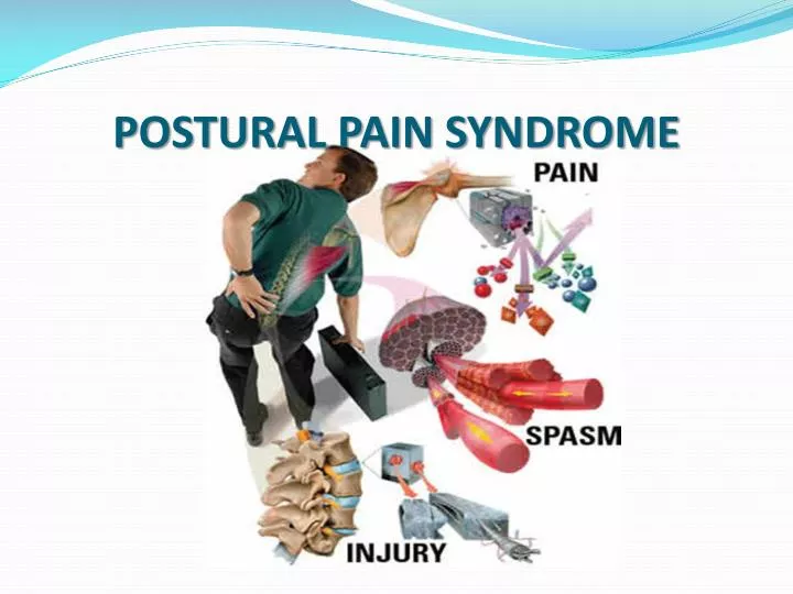 postural pain syndrome