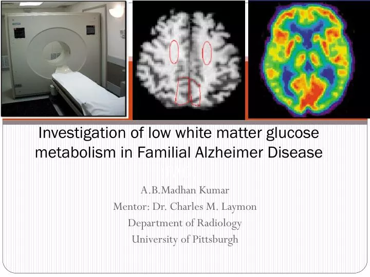 investigation of low white matter glucose metabolism in familial alzheimer disease fad