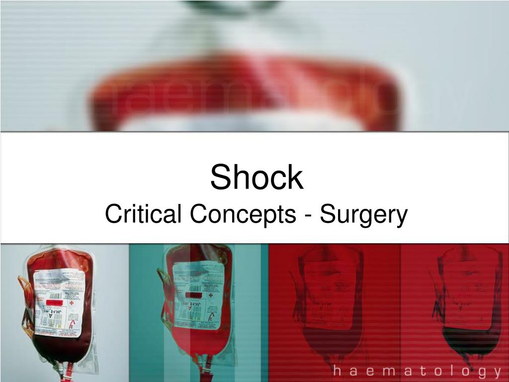PPT - Shock PowerPoint Presentation, free download - ID:2200042