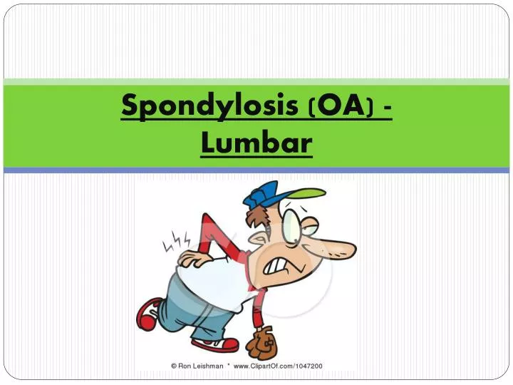 spondylosis oa lumbar